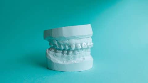 Plaster mould of human jaw with transparent mouthguard for bruxism
